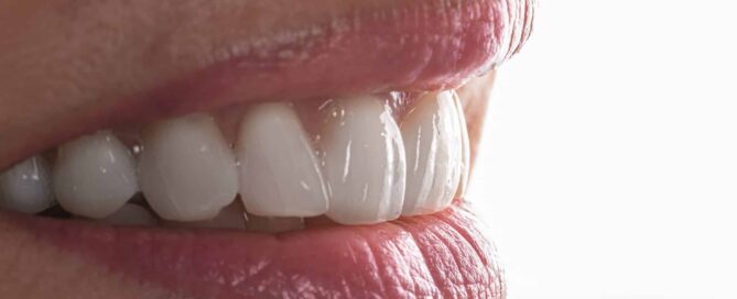 Two front teeth-5
