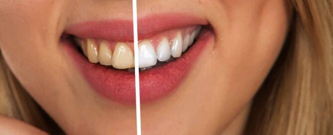 benefits of seeing a prosthodontist