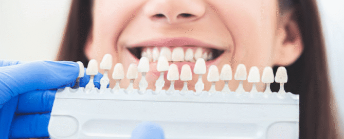 teeth replacement
