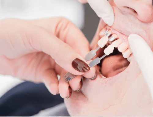 Restoring Broken Teeth: Advanced Techniques and Outcomes