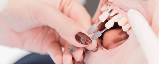 restoring broken teeth