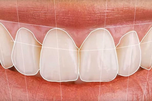 DigitalSmileDesign