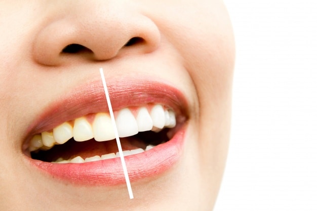 whitening